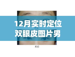 雙眼皮蛻變之旅，從學(xué)習(xí)到自信的華麗轉(zhuǎn)身，實(shí)時定位雙眼皮圖片男展示十二月的蛻變歷程