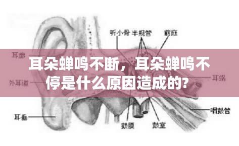 耳朵蟬鳴不斷，耳朵蟬鳴不停是什么原因造成的? 