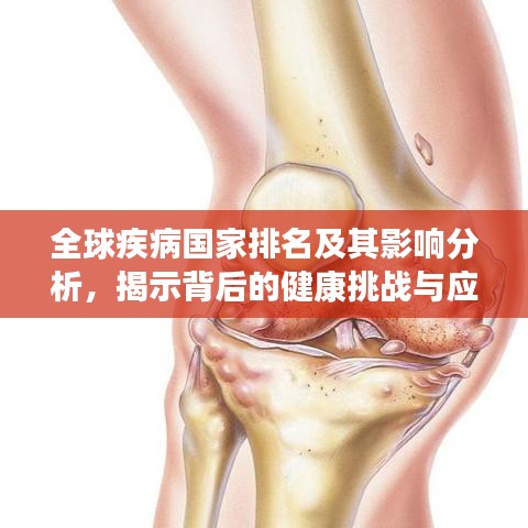 全球疾病國家排名及其影響分析，揭示背后的健康挑戰(zhàn)與應對策略